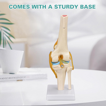 Load image into Gallery viewer, Vibeat Life-Size Human Knee Joint Anatomy Model with Flexible Ligaments, Anatomical Knee Skeleton Model with Study Card &amp; Display Base, PVC Medical Teaching Model for Anatomy Education
