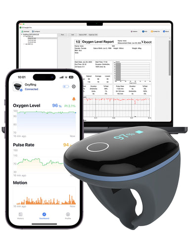 Vibeat OxyRing Oximeter